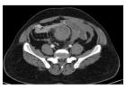 Teleradiology Services in india