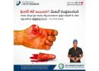 Top Hand and Finger Injury Doctor in Nellore for Emergency Surgery