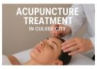 Acupuncture Treatment: A Natural Path to Healing and Wellness in Culver City