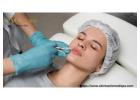 Enhance Your Natural Beauty with Lip Fillers Riverside 