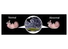 Best NT SCAN | Fetal India