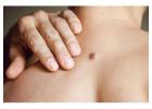 Cyst Removal Islington – Trusted Skin Specialists at London Dermatology Clinics