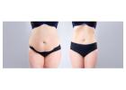 Tummy Tuck Surgery cost in Delhi - Dr Rajat Gupta