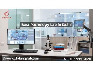 Best Pathology Lab in Delhi