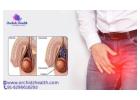 Best Varicocele Treatment in Bangalore for Men at Orchidz Health