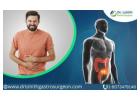 Best Gastrointestinal Oncology Surgery in Sarjapur Road by Dr. Lohith U