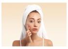 Clear Skin Awaits with Acne Facial Southgate MI