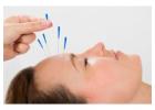 Headaches Acupuncture Middle Tennessee – Natural Healing for Lasting Relief