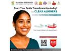 Best Doctor for Invisalign Clear Aligners in Nellore