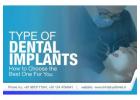 Get the Best Dental Implants in Gurgaon at Ministry of Smile