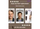 same day hair replacement- Hair Fixing Zone 