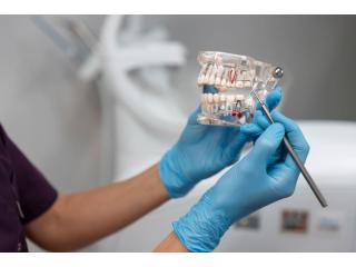 Teeth Whitening Dentist – Brighten Your Smile with Pleasant Dental