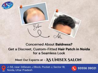 Restore Your Confidence with the Best Hair Patch in Noida at AS Unisex Salon!