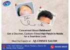 Restore Your Confidence with the Best Hair Patch in Noida at AS Unisex Salon!