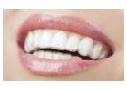 Aronson Orthodontics Invisalign Treatment Plan for a Confident Smile