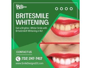 Brighten Your Smile with the Best Teeth Whitening Near You – Smile Designs 101, Somerset, NJ