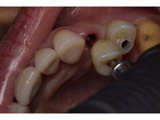 Trusted Dental Clinic in Tijuana – Comprehensive Care for a Brighter, Healthier Smile