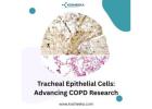 Tracheal Epithelial Cells: Advancing COPD Research