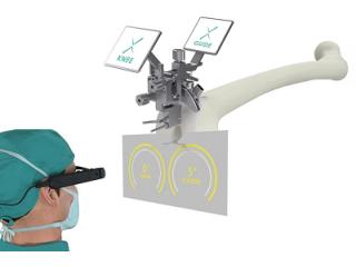 Looking for a reliable knee replacement in Ahmedabad?