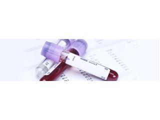 Drug Test Supplies McAllen Texas