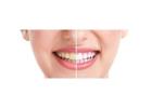 New Teeth Whitening Options in Chippewa Falls 2025