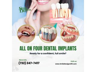 All-on-4 Dental Implants: A Complete Solution for Missing Teeth