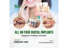 All-on-4 Dental Implants: A Complete Solution for Missing Teeth
