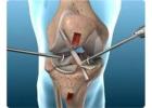 Top Orthopedic Doctor in Jaipur - Dr. Sanjay Rawat