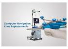 Computer-Assisted Navigated Knee Replacement in Delhi | Dr. (Prof.) Anil Arora