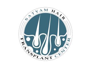 PRP Treatment in Ludhiana | Satyam Hair Transplant