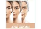 Get the Best Treatment for Deep Wrinkles on Face in Thane at DNA Royal Aesthetic Clinic.
