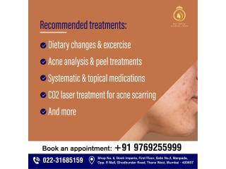 Get the Best Acne Treatment in Thane at DNA Royal Aesthetic Clinic.