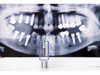 Dental Implant Specials Smile Designs 101 Somerset, NJ