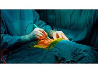 lung cancer doctor in delhi