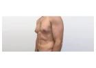 How the OCCULT Technique Is Changing Gynecomastia Treatment?