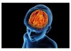 Safe & Modern Neurosurgical Solutions for Children