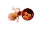 Best Treatment for Pancreatic Cancer in Mumbai by Experienced Specialist