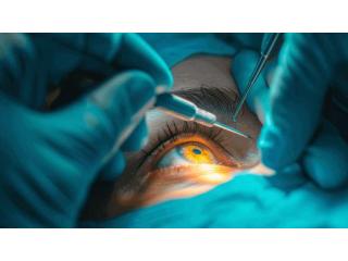 Restore Clear Sight: Advanced Cataract Surgery in Bardhaman at Drishtideep