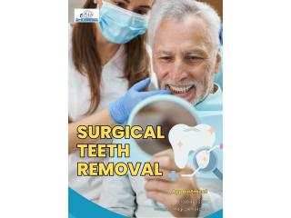 Surgical Teeth Removal Services | A to Z Dental