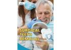 Surgical Teeth Removal Services | A to Z Dental