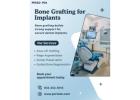 Are You a Candidate for Bone Grafting?