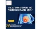Breast Cancer Stages and Prognosis Explained Simply