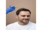 Get the Perfect Hairline with Expert Hair Transplant in Thane at DNA Royal Clinic