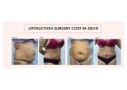 Liposuction Surgery Cost in Delhi: What’s Included and What’s Not