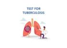 TB (Tuberculosis) Test in Delhi & Gurgaon
