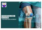 Looking for a Pixee Medical Knee ar system for knee replacement