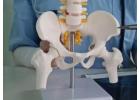 Hip Replacement Surgeon in Ahmedabad | Expert Treatment at Elite Hospital