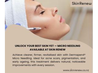 Look Refreshed with Cosmetic Injectables in Auckland