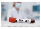 ESR / SED Rate Test in Delhi and Gurgaon