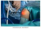 Best Arthroscopy Surgery in Ahmedabad | Elite Hospital